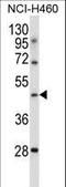 TLE Family Member 6, Subcortical Maternal Complex Member antibody, LS-C161914, Lifespan Biosciences, Western Blot image 