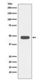 NFKB Inhibitor Beta antibody, M05766, Boster Biological Technology, Western Blot image 