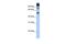 FEZ Family Zinc Finger 1 antibody, PA5-43562, Invitrogen Antibodies, Western Blot image 