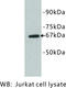Selectin E antibody, MBS355142, MyBioSource, Western Blot image 