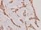 Nucleolar Protein Interacting With The FHA Domain Of MKI67 antibody, A04797, Boster Biological Technology, Immunohistochemistry frozen image 