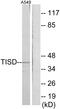 ZFP36 Ring Finger Protein Like 2 antibody, GTX87458, GeneTex, Western Blot image 