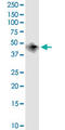 Branched Chain Amino Acid Transaminase 1 antibody, LS-C196736, Lifespan Biosciences, Western Blot image 