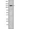 Inhibitor Of Bruton Tyrosine Kinase antibody, abx216123, Abbexa, Western Blot image 