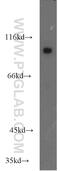 Coatomer Protein Complex Subunit Gamma 2 antibody, 16111-1-AP, Proteintech Group, Western Blot image 