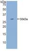 Interleukin 2 Receptor Subunit Gamma antibody, LS-C300775, Lifespan Biosciences, Western Blot image 