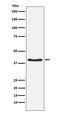 Pyruvate Dehydrogenase E1 Alpha 1 Subunit antibody, P01906, Boster Biological Technology, Western Blot image 