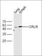 Calcitonin Receptor Like Receptor antibody, orb13353, Biorbyt, Western Blot image 