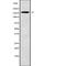 ATP Binding Cassette Subfamily C Member 11 antibody, abx147868, Abbexa, Western Blot image 