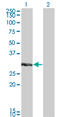 Kv channel-interacting protein 2 antibody, LS-C105138, Lifespan Biosciences, Western Blot image 