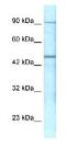 Gamma-Aminobutyric Acid Type A Receptor Pi Subunit antibody, ab26055, Abcam, Western Blot image 