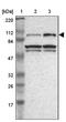 DEAD-Box Helicase 20 antibody, NBP1-84058, Novus Biologicals, Western Blot image 