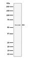 Intercellular Adhesion Molecule 2 antibody, M04901-1, Boster Biological Technology, Western Blot image 