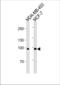 Angiotensin I Converting Enzyme 2 antibody, TA328186, Origene, Western Blot image 