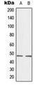 C-Terminal Binding Protein 2 antibody, MBS8225776, MyBioSource, Western Blot image 