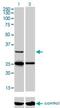 Steroidogenic Acute Regulatory Protein antibody, H00006770-M01, Novus Biologicals, Western Blot image 