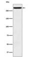 Complement C3b/C4b Receptor 1 (Knops Blood Group) antibody, M01022-2, Boster Biological Technology, Western Blot image 