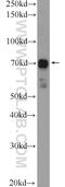 CAP-Gly Domain Containing Linker Protein Family Member 4 antibody, 17044-1-AP, Proteintech Group, Enzyme Linked Immunosorbent Assay image 