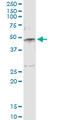 Serpin Family E Member 1 antibody, LS-C197840, Lifespan Biosciences, Immunoprecipitation image 