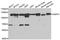 Heat Shock Protein Family H (Hsp110) Member 1 antibody, A6622, ABclonal Technology, Western Blot image 