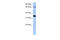 GLE1 RNA Export Mediator antibody, 26-893, ProSci, Western Blot image 