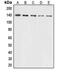 Collagen Type III Alpha 1 Chain antibody, MBS822102, MyBioSource, Western Blot image 