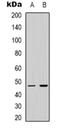 LUC7 Like 2, Pre-MRNA Splicing Factor antibody, orb319032, Biorbyt, Western Blot image 