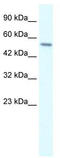 Regulator Of G Protein Signaling 6 antibody, TA334727, Origene, Western Blot image 