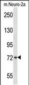 PRK antibody, PA5-48707, Invitrogen Antibodies, Western Blot image 