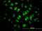 Scaffold Attachment Factor B2 antibody, LS-B4411, Lifespan Biosciences, Immunofluorescence image 