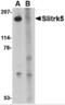 SLIT and NTRK-like protein 5 antibody, NBP2-81915, Novus Biologicals, Western Blot image 