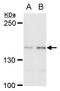 SURP And G-Patch Domain Containing 2 antibody, GTX129794, GeneTex, Western Blot image 