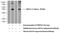 Outer Dense Fiber Of Sperm Tails 3 Like 2 antibody, 25051-1-AP, Proteintech Group, Western Blot image 