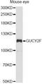 Guanylate Cyclase 2F, Retinal antibody, A14242, ABclonal Technology, Western Blot image 