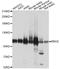 MutS Homolog 2 antibody, LS-C331272, Lifespan Biosciences, Western Blot image 