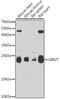 Ubiquitin Conjugating Enzyme E2 T antibody, A6853, ABclonal Technology, Western Blot image 