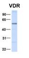 Vitamin D Receptor antibody, orb329948, Biorbyt, Western Blot image 