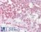Centriolar Coiled-Coil Protein 110 antibody, LS-B8825, Lifespan Biosciences, Immunohistochemistry paraffin image 