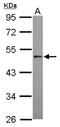 MAPK Activated Protein Kinase 5 antibody, NBP2-19922, Novus Biologicals, Western Blot image 