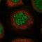 Ubiquitin Specific Peptidase 45 antibody, PA5-56205, Invitrogen Antibodies, Immunofluorescence image 