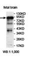 Zinc Finger Protein 227 antibody, orb78019, Biorbyt, Western Blot image 
