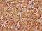 Large Tumor Suppressor Kinase 1 antibody, LS-C678477, Lifespan Biosciences, Immunohistochemistry paraffin image 