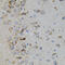 Mitogen-Activated Protein Kinase 11 antibody, 23-126, ProSci, Immunohistochemistry paraffin image 