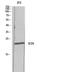 Inducible T Cell Costimulator antibody, STJ97666, St John