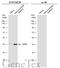 JunB Proto-Oncogene, AP-1 Transcription Factor Subunit antibody, GTX134236, GeneTex, Western Blot image 