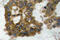 AKT Serine/Threonine Kinase 2 antibody, LS-C178000, Lifespan Biosciences, Immunohistochemistry frozen image 