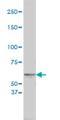Tyrosinase antibody, H00007299-M01, Novus Biologicals, Western Blot image 