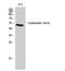 Keratin 14 antibody, STJ92627, St John