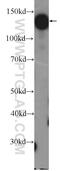 Diphosphoinositol Pentakisphosphate Kinase 2 antibody, 26018-1-AP, Proteintech Group, Western Blot image 