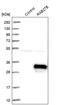 RAB27B, Member RAS Oncogene Family antibody, PA5-54096, Invitrogen Antibodies, Western Blot image 